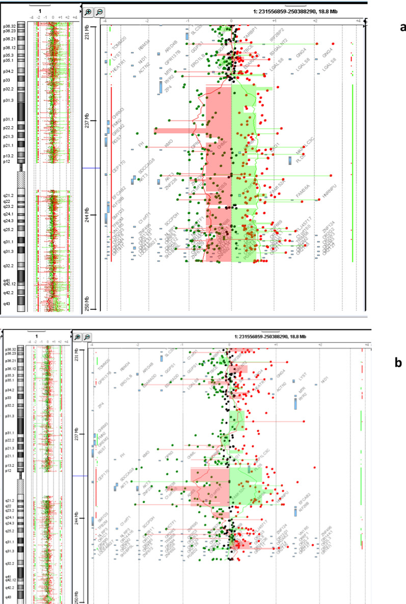 Clinical and molecular characterization of 1q43q44 deletion and corpus callosum malformations: 2 new cases and literature review.