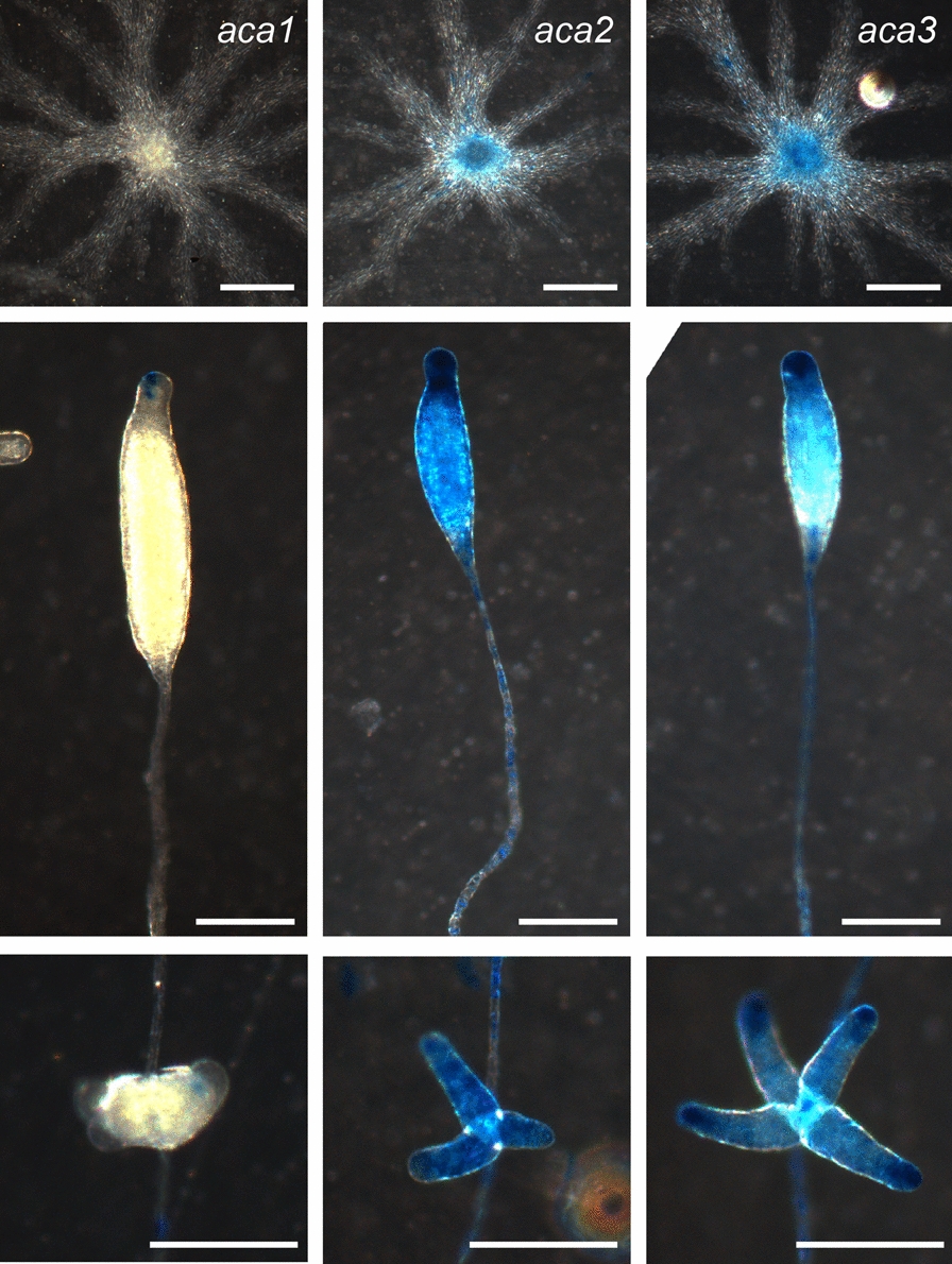 Adenylate cyclase A amplification and functional diversification during Polyspondylium pallidum development.