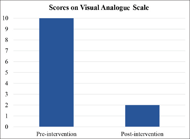 Effectiveness of Neurofeedback Therapy Adjunct to Cognitive Behavioral Therapy in Agoraphobia: A Case Study.