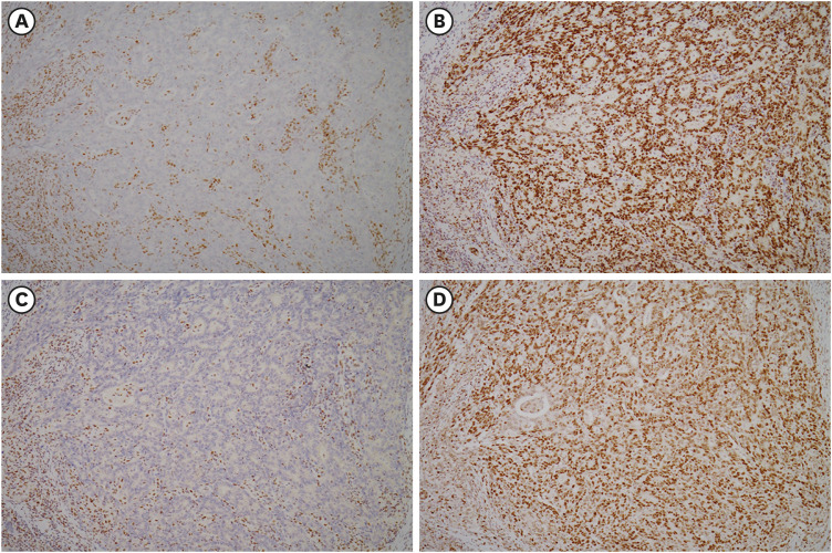 Molecular Pathology of Gastric Cancer.