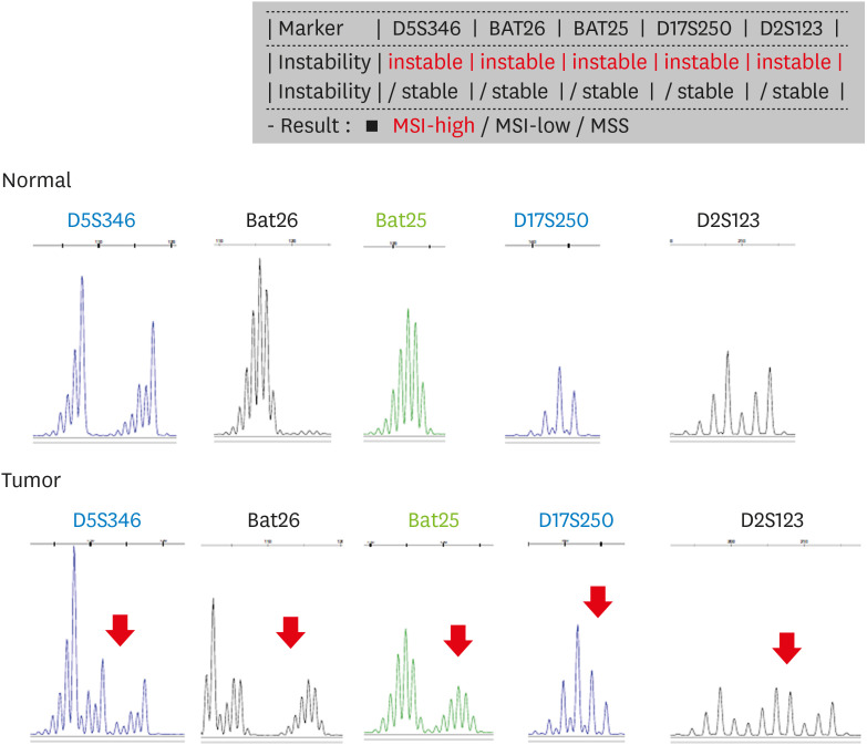 Molecular Pathology of Gastric Cancer.