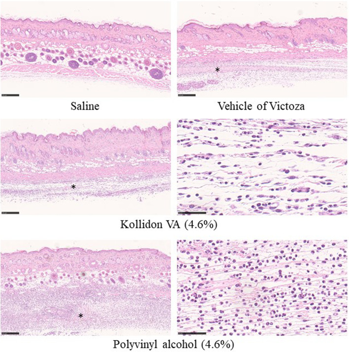 <i>In vivo</i> screening of subcutaneous tolerability for the development of novel excipients.