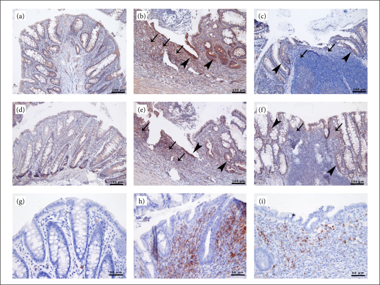 Mesenchymal stem cells have ameliorative effect on the colitis model via Nrf2/HO-1 pathway.