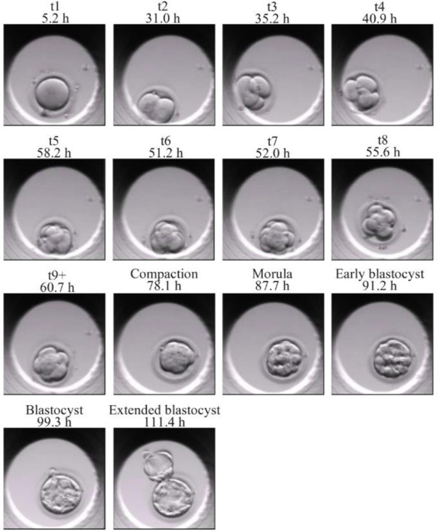 A Homogeneous Ensemble of Robust Pre-defined Neural Network Enables Automated Annotation of Human Embryo Morphokinetics.