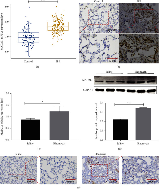 Inhibition of MAD2L1 Mediates Pulmonary Fibrosis through Impairment of Mitochondrial Function and Induction of Cell Senescence.