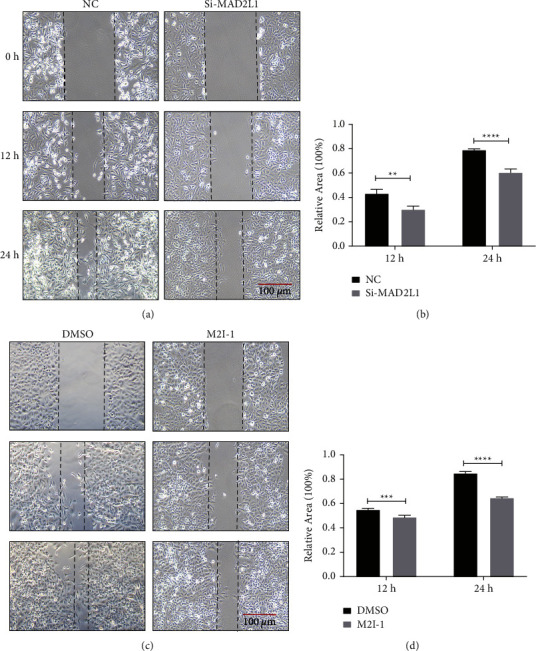 Inhibition of MAD2L1 Mediates Pulmonary Fibrosis through Impairment of Mitochondrial Function and Induction of Cell Senescence.