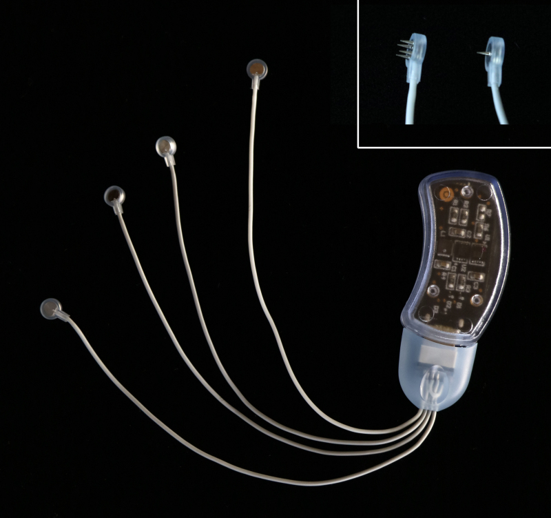 Percutaneous Auricular Nerve Stimulation (Neuromodulation) for Analgesia and Opioid-Sparing Following Knee and Hip Arthroplasty: A Proof-of-Concept Case Series.