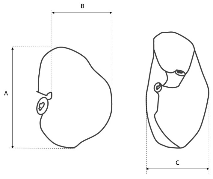 Equine Stomach Development in the Fetal Period: An Anatomical, Topographical, and Morphometric Study.