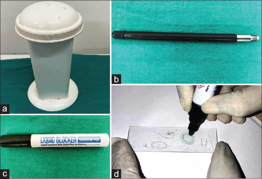 Immunocytochemical Evaluation of TTF-1, Napsin-A, and p-63 for Subtyping of Non-Small Cell Lung Carcinoma and Clinicopathological Correlation.