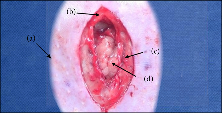 Incisional hernia repair in rats: description of the sublay technique under videomagnification system.