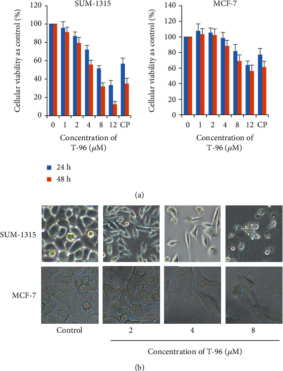 Antitumor Effect of Demethylzeylasteral (T-96) on Triple-Negative Breast Cancer via LSD1-Mediate Epigenetic Mechanisms.