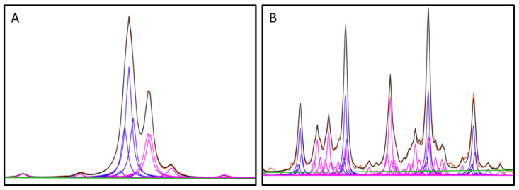 Vantera Mediated Quantification of Urine Citrate and Creatinine: A New Technology to Assess Risk of Nephrolithiasis.