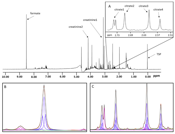 Vantera Mediated Quantification of Urine Citrate and Creatinine: A New Technology to Assess Risk of Nephrolithiasis.