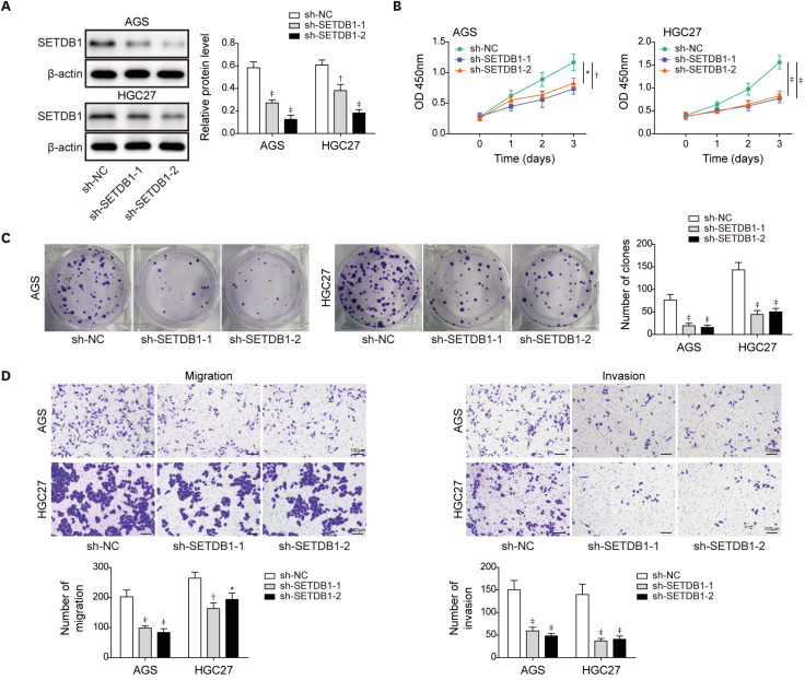 Sp1-Induced SETDB1 Overexpression Transcriptionally Inhibits HPGD in a β-Catenin-Dependent Manner and Promotes the Proliferation and Metastasis of Gastric Cancer.