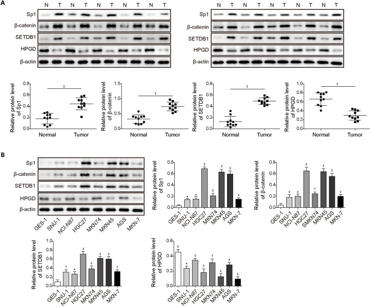 Sp1-Induced SETDB1 Overexpression Transcriptionally Inhibits HPGD in a β-Catenin-Dependent Manner and Promotes the Proliferation and Metastasis of Gastric Cancer.