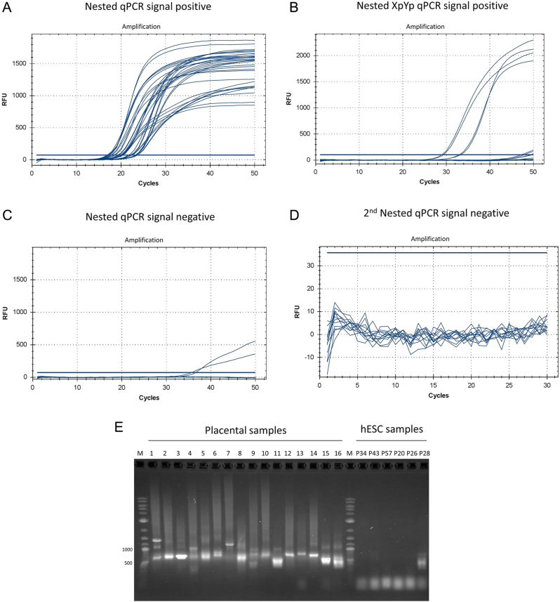 Telomere fusions as a signal of term placental aging? A pilot study.