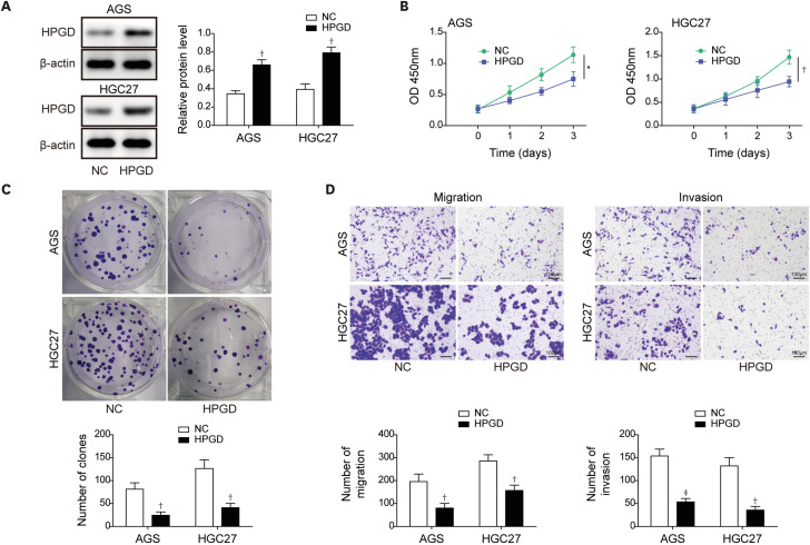 Sp1-Induced SETDB1 Overexpression Transcriptionally Inhibits HPGD in a β-Catenin-Dependent Manner and Promotes the Proliferation and Metastasis of Gastric Cancer.