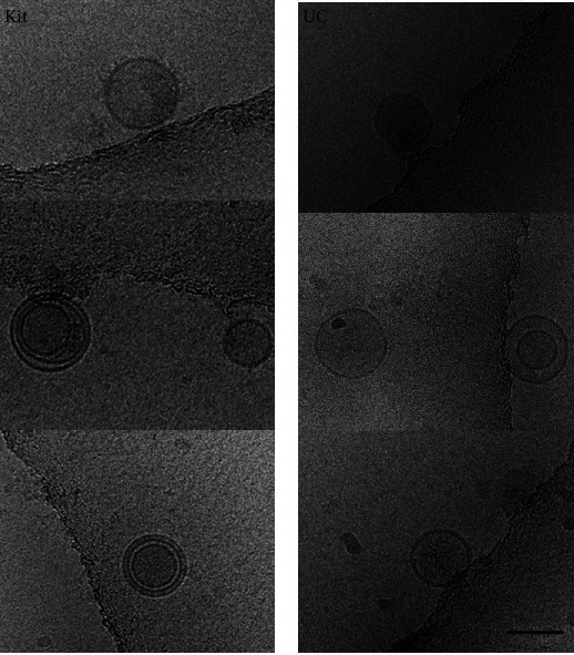 Comparing Two Methods for the Isolation of Exosomes.