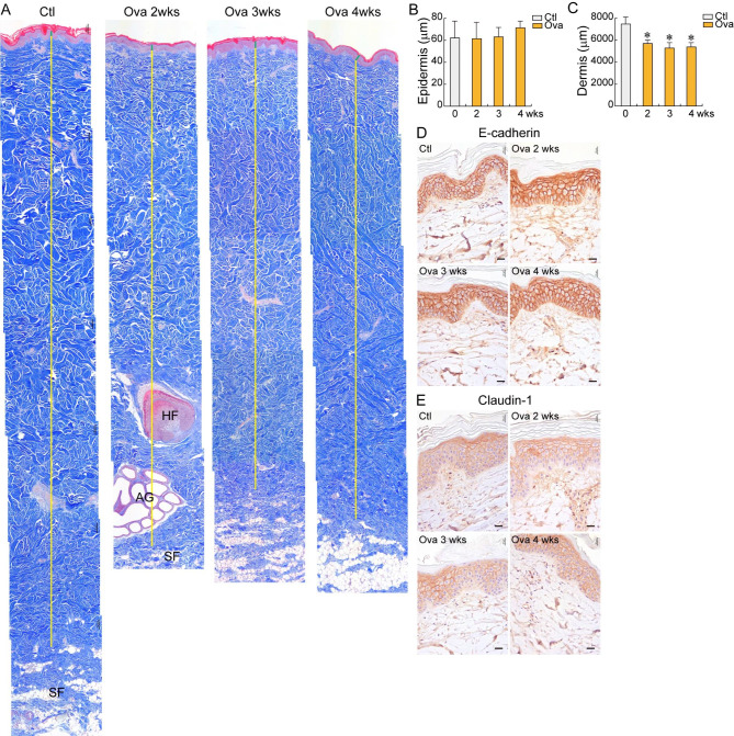 Key factors to establish the ovalbumin-induced atopic dermatitis minipig model: age and body weight.