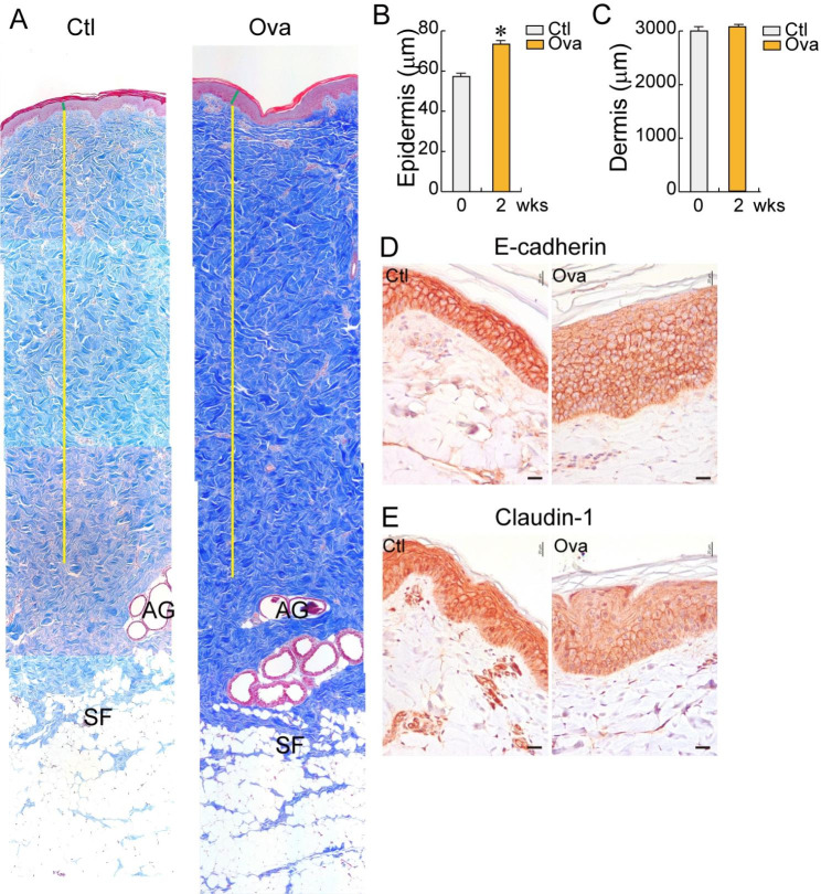 Key factors to establish the ovalbumin-induced atopic dermatitis minipig model: age and body weight.