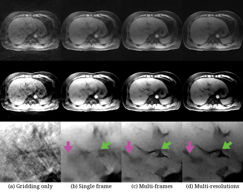 Deep Learning and Its Application to Function Approximation for MR in Medicine: An Overview.