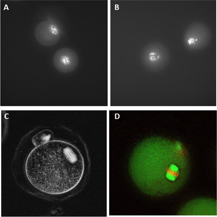 New hyaluronan-based biomatrix for 3-D follicle culture yields functionally competent oocytes.