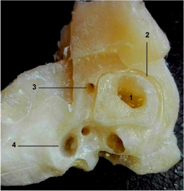 Morphology and morphometry of the inner ear of the dromedary camel and their influence on the efficiency of hearing and equilibrium.