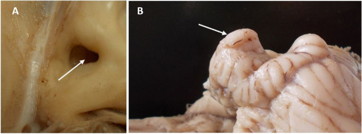 Morphology and morphometry of the inner ear of the dromedary camel and their influence on the efficiency of hearing and equilibrium.