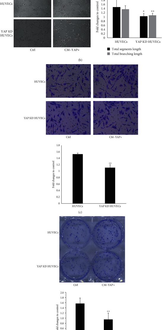 YAP Overexpression in Breast Cancer Cells Promotes Angiogenesis through Activating YAP Signaling in Vascular Endothelial Cells.