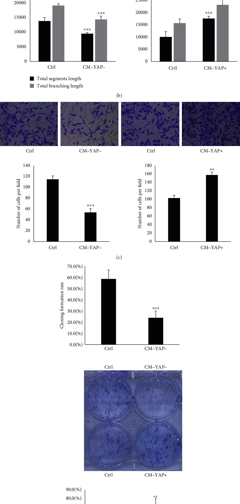 YAP Overexpression in Breast Cancer Cells Promotes Angiogenesis through Activating YAP Signaling in Vascular Endothelial Cells.