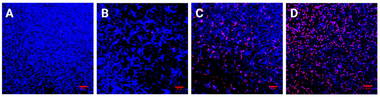 Photodynamic Inactivation Effectively Eradicates <i>Candida auris</i> Biofilm despite Its Interference with the Upregulation of <i>CDR1</i> and <i>MDR1</i> Efflux Genes.