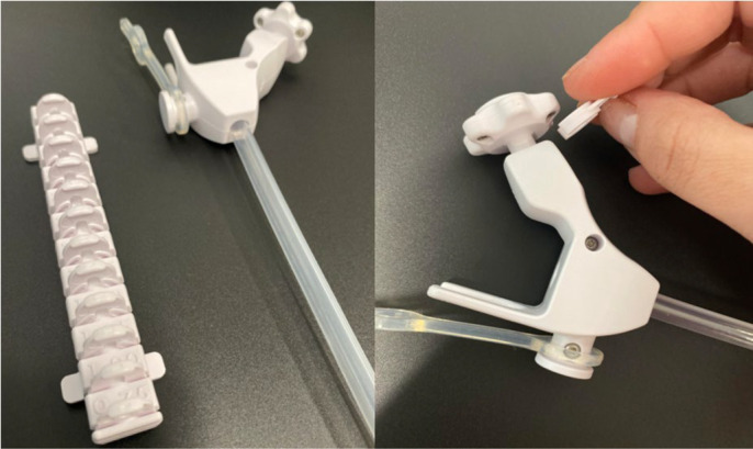 A Clean Sweep: Initial Experience with a Novel Intracavity Laparoscopic Cleaning Device.