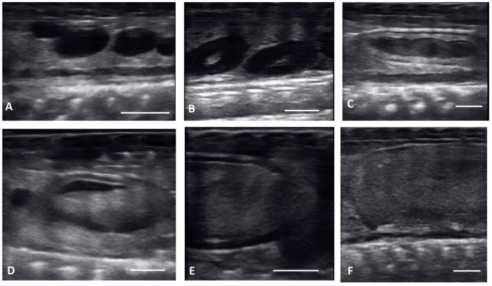 Ultrasound Description of Follicular Development in the Louisiana Pinesnake (<i>Pituophis ruthveni</i>, Stull 1929).