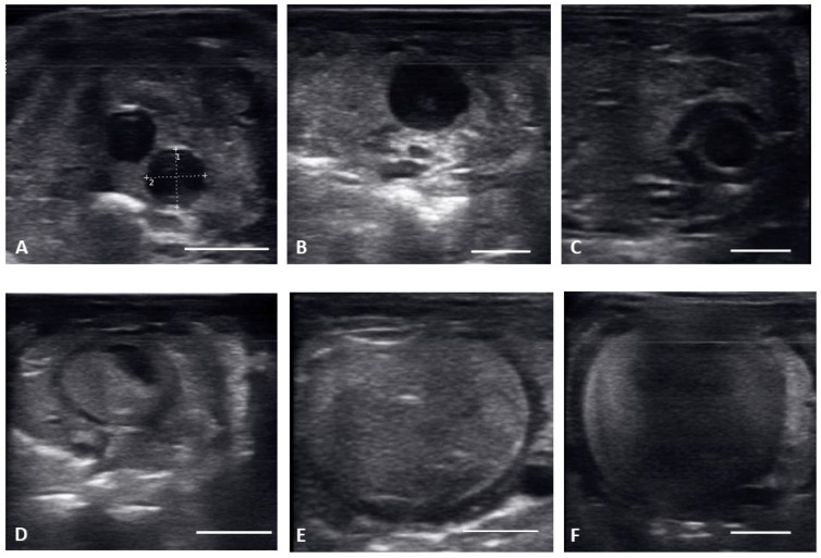 Ultrasound Description of Follicular Development in the Louisiana Pinesnake (<i>Pituophis ruthveni</i>, Stull 1929).