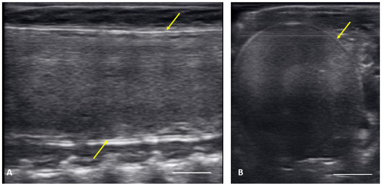 Ultrasound Description of Follicular Development in the Louisiana Pinesnake (<i>Pituophis ruthveni</i>, Stull 1929).