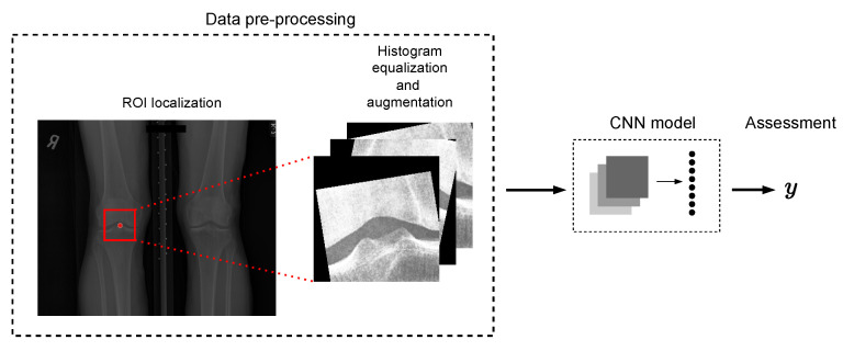An Automatic Method for Assessing Spiking of Tibial Tubercles Associated with Knee Osteoarthritis.