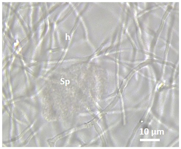 Root Nodule Microsymbionts of Native <i>Coriaria myrtifolia</i> in Algeria.