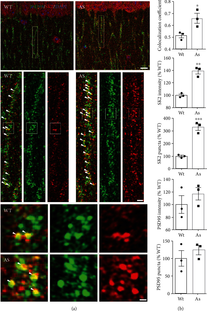 Lack of UBE3A-Mediated Regulation of Synaptic SK2 Channels Contributes to Learning and Memory Impairment in the Female Mouse Model of Angelman Syndrome.