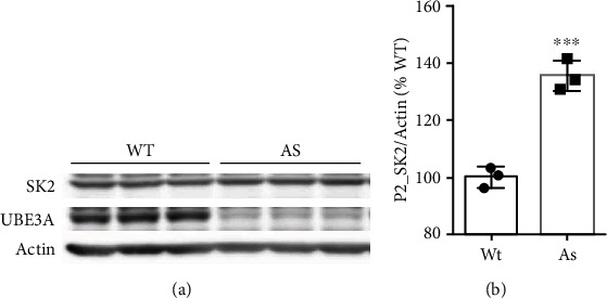 Lack of UBE3A-Mediated Regulation of Synaptic SK2 Channels Contributes to Learning and Memory Impairment in the Female Mouse Model of Angelman Syndrome.