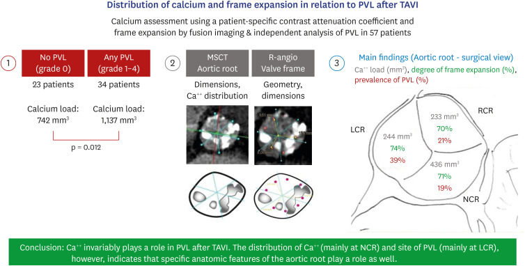 Distribution of Aortic Root Calcium in Relation to Frame Expansion and Paravalvular Leakage After Transcatheter Aortic Valve Implantation (TAVI): An Observational Study Using a Patient-specific Contrast Attenuation Coefficient for Calcium Definition and Independent Core Lab Analysis of Paravalvular Leakage.