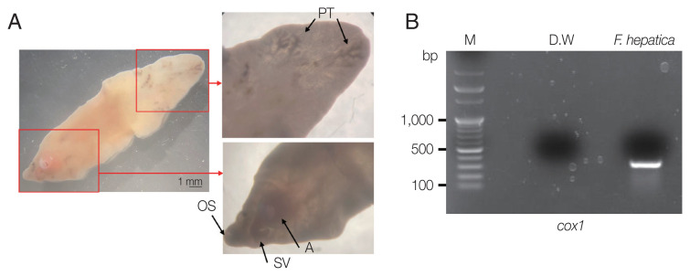 Phylogenetic Characteristics of Fasciola hepatica Isolated from a Korean Patient.