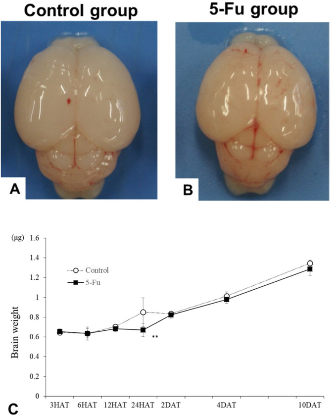 Changes in 5-Fluorouracil-induced external granular cell damage during the time-course of the developing cerebellum of infant rats.