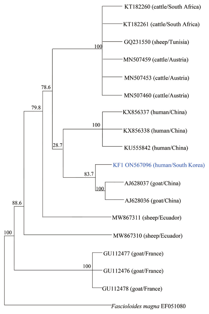 Phylogenetic Characteristics of Fasciola hepatica Isolated from a Korean Patient.