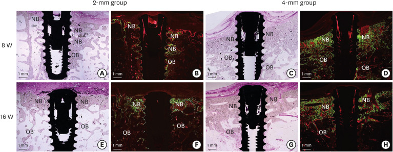 The healing pattern of a 4 mm proximal infrabony defect was not significantly different from a 2 mm defect adjacent to dental implant in a canine mandible.