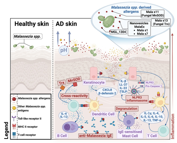 The Role of the Cutaneous Mycobiome in Atopic Dermatitis.