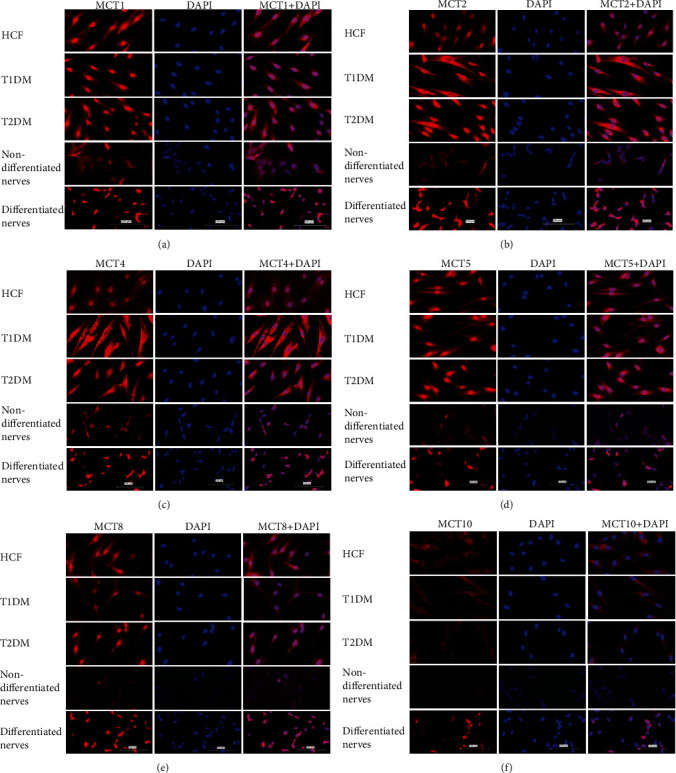 Monocarboxylate Transporters: Role and Regulation in Corneal Diabetes.