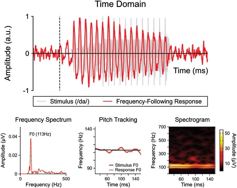 Neonatal Frequency-Following Responses: A Methodological Framework for Clinical Applications.