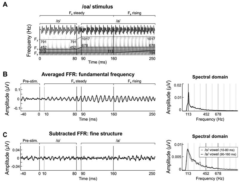 Neonatal Frequency-Following Responses: A Methodological Framework for Clinical Applications.