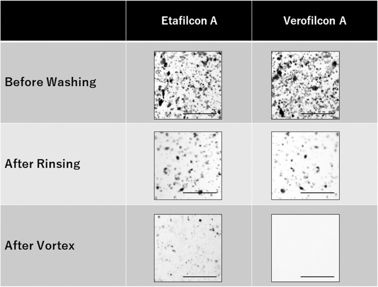 Adhesion of Asian Dust Particles to Verofilcon a Soft Contact Lenses.
