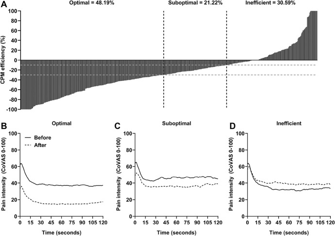 Clusters of facilitatory and inhibitory conditioned pain modulation responses in a large sample of children, adolescents, and young adults with chronic pain.